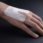 چسب آنژیوکت - Image 2